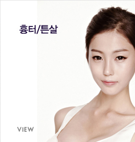 banner_15
